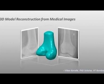 Software that turns 2D X-ray images into 3D models