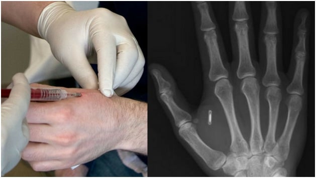 Various Companies Are Planning To Implant Microchips In Their Worker's Hands