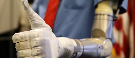 Two Pakistani engineers have developed a prosthetic arm which can be controlled using the brain